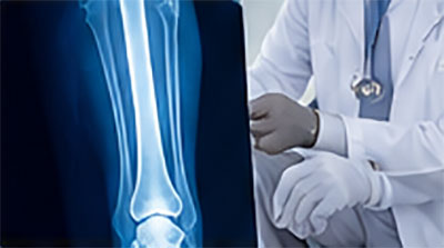 Fracture, Injury & Trauma Care
